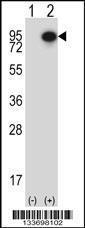 Anti-CTTN Rabbit Polyclonal Antibody