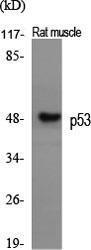 Western blot analysis of various cells using Anti-p53 Antibody