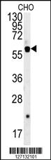 Anti-SLC16A9 Rabbit Polyclonal Antibody