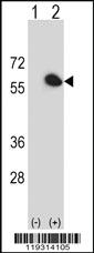 Anti-DHRS7C Rabbit Polyclonal Antibody