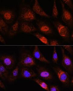 Immunofluorescence analysis of NIH/3T3 cells using Anti-ZC3H12D Antibody (A308326) at a dilution of 1:100. DAPI was used to stain the cell nuclei (blue).