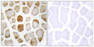 Immunohistochemical analysis of paraffin-embedded human skeletal muscle tissue using Anti-ATG4B Antibody. The right hand panel represents a negative control, where the antibody was pre-incubated with the immunising peptide