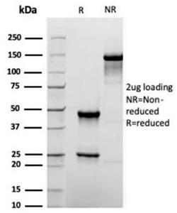 SDS-PAGE analysis of Anti-TROP2 Antibody [rTACSTD2/6397] under non-reduced and reduced conditions; showing intact IgG and intact heavy and light chains, respectively. SDS-PAGE analysis confirms the integrity and purity of the antibody