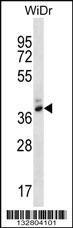 Anti-PGA4 Rabbit Polyclonal Antibody