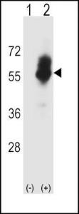 Anti-SLC7A1 Rabbit Polyclonal Antibody (PE (Phycoerythrin))