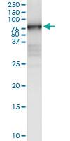 Anti-MMP3 Polyclonal Antibody Pair