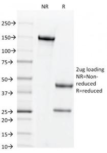 SDS-PAGE analysis of Anti-CD44v3 Antibody [2F10] under non-reduced and reduced conditions; showing intact IgG and intact heavy and light chains, respectively. SDS-PAGE analysis confirms the integrity and purity of the antibody