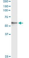 Anti-MMP3 Antibody Pair