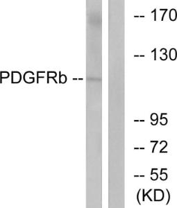 Western blot analysis of lysates from LOVO cells using Anti-PDGF Receptor beta Antibody. The right hand lane represents a negative control, where the antibody is blocked by the immunising peptide.