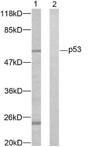 Western blot analysis of lysates from K562 cells using Anti-p53 Antibody The right hand lane represents a negative control, where the antibody is blocked by the immunising peptide