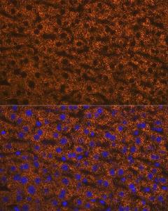 Immunofluorescence analysis of mouse liver using Anti-ANGPTL3 Antibody [ARC1214] (A307333) at a dilution of 1:100 (40X lens). DAPI was used to stain the cell nuclei (blue)