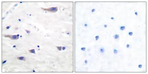 Immunohistochemical analysis of paraffin-embedded human brain tissue using Anti-PDGF Receptor beta Antibody. The right hand panel represents a negative control, where the antibody was pre-incubated with the immunising peptide.