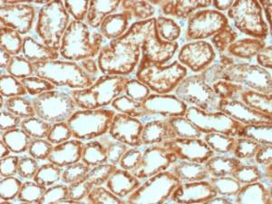 Immunohistochemical analysis of formalin-fixed, paraffin-embedded human renal cell carcinoma using Anti-EPO Antibody [EPO/1368]