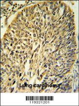 Anti-FKBP9 Rabbit Polyclonal Antibody