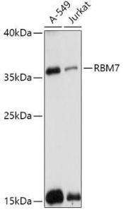 Western blot analysis of extracts of various cell lines, using Anti-RBM7 Antibody (A307334) at 1:1,000 dilution. The secondary antibody was Goat Anti-Rabbit IgG H&L Antibody (HRP) at 1:10,000 dilution.