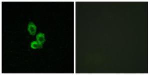 Immunofluorescence analysis of HepG2 cells using Anti-PDGF Receptor beta Antibody. The right hand panel represents a negative control, where the antibody was pre-incubated with the immunising peptide.