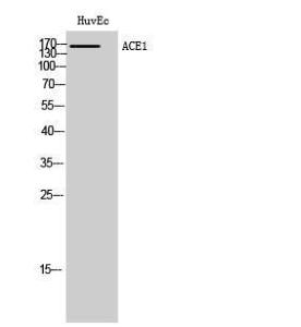 Western blot analysis of HuvEc cells using Anti-ACE1 Antibody