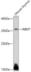 Western blot analysis of extracts of Mouse thymus, using Anti-RBM7 Antibody (A307334) at 1:1,000 dilution. The secondary antibody was Goat Anti-Rabbit IgG H&L Antibody (HRP) at 1:10,000 dilution.