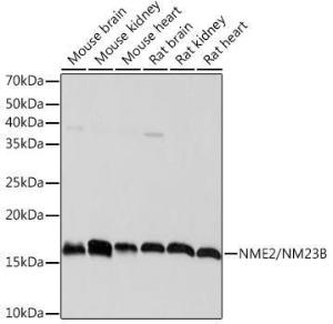 Western blot analysis of extracts of various cell lines, using Anti-NME2 Antibody [ARC1412] (A308328) at 1:1000 dilution. The secondary Antibody was Goat Anti-Rabbit IgG H&L Antibody (HRP) at 1:10000 dilution. Lysates/proteins were present at 25 µg per lane