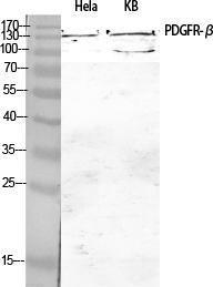 Western blot analysis of various cells using Anti-PDGF Receptor beta Antibody