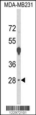 Anti-EMX1 Rabbit Polyclonal Antibody