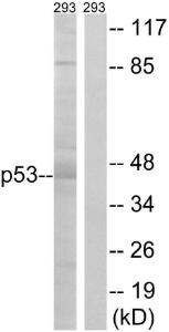 Western blot analysis of lysates from 293 cells using Anti-p53 Antibody. The right hand lane represents a negative control, where the antibody is blocked by the immunising peptide.