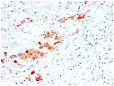 Anti-CD44v4 antibody