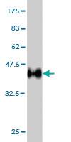 Anti-EPHB6 Mouse Monoclonal Antibody [clone: 5D8]