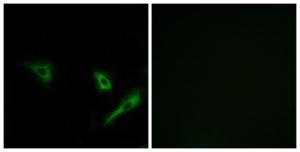 Antibody anti-ATG4A 100 µg