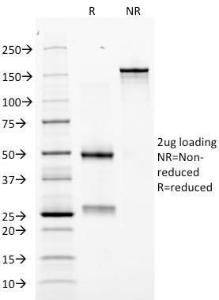 SDS-PAGE analysis of Anti-EPO Antibody [EPO/1368] under non-reduced and reduced conditions; showing intact IgG and intact heavy and light chains, respectively. SDS-PAGE analysis confirms the integrity and purity of the antibody