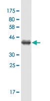 Anti-PCBP1 Mouse Monoclonal Antibody [clone: 1G2]