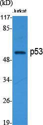 Western blot analysis of various cells using Anti-p53 Antibody