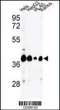 Anti-GOT2 Rabbit Polyclonal Antibody