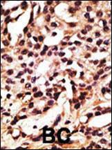 Anti-ATG12 Rabbit Polyclonal Antibody