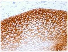 Anti-CD44v4 antibody