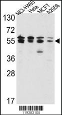 Anti-PIK3IP1 Rabbit Polyclonal Antibody