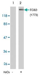 Anti-ITGB3 Rabbit Polyclonal Antibody