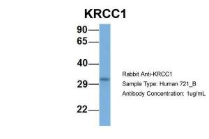 Anti-KRCC1 Rabbit Polyclonal Antibody