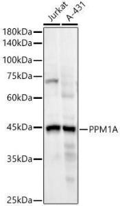 Western blot analysis of extracts of various cell lines, using Anti-PPM1A Antibody [ARC55164] (A307336) at 1:20,000 dilution