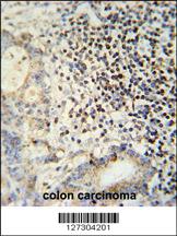 Anti-ESRP1 Rabbit Polyclonal Antibody