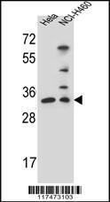 Anti-NTHL1 Rabbit Polyclonal Antibody (FITC (Fluorescein Isothiocyanate))