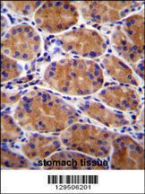 Anti-GIN1 Rabbit Polyclonal Antibody (Biotin)