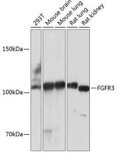 Western blot analysis of extracts of various cell lines, using Anti-FGFR3 Antibody [ARC0398] (A307337) at 1:1,000 dilution. The secondary antibody was Goat Anti-Rabbit IgG H&L Antibody (HRP) at 1:10,000 dilution.