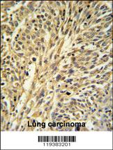 Anti-PIK3IP1 Rabbit Polyclonal Antibody