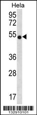 Anti-CHI3L2 Rabbit Polyclonal Antibody