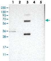 Anti-GALNT15 Rabbit Polyclonal Antibody