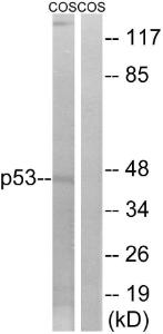 Antibody anti-P53 A101604-100 100 µg