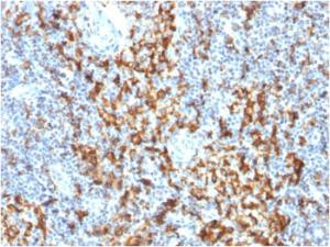 Immunohistochemical analysis of formalin-fixed, paraffin-embedded human lymph node using Anti-CD163 Antibody [M130/1210]