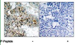 Anti-ITGB3 Rabbit Polyclonal Antibody