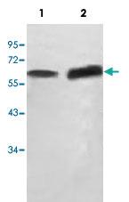 Anti-SCP2 Rabbit Polyclonal Antibody